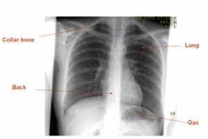 Digital X-Ray - South East Radiology